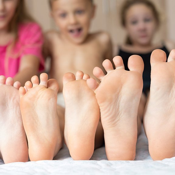 Fußpilz bei Kindern behandeln