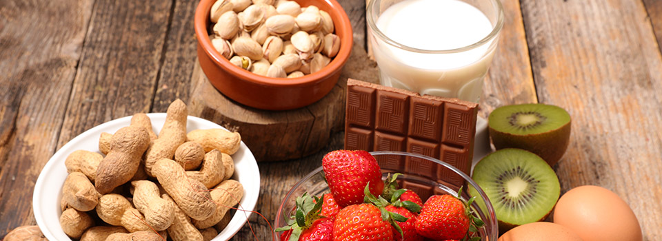 Auf einem Tisch liegen Lebensmittel, zum Beispiel Schokolade, Nüsse, Kiwi, Erdbeeren, Eier und Milch.